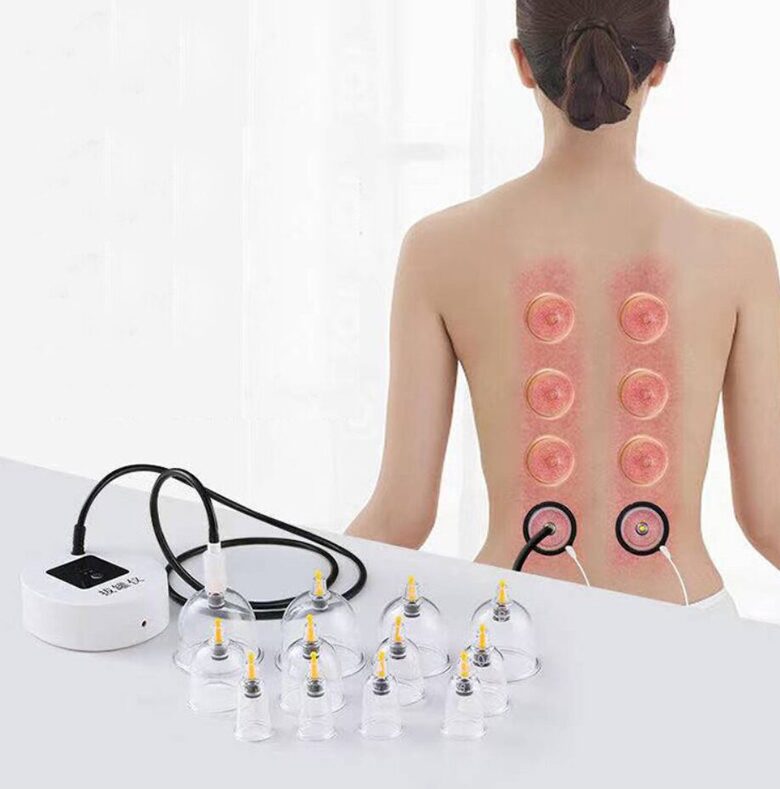 Vakuuma bankas 12gab, ārstnieciskās masāža (ar akumulatoru, 1200mA)